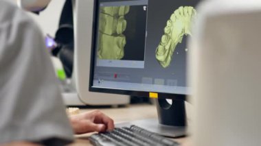 Diş protozoası kaplamaları ve kaplamaları üretmek için profesyonel laboratuarı kapatın. Bir tarama makinesi diş izi oluşturmak için 360 derece döngü profesyonel denetim