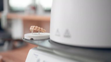 Diş protezleri üretimi için yakın plan profesyonel laboratuvar. Kaplamalar, kaplamalar, diş izlerinin ısısı, maddenin sabitlenmesi.