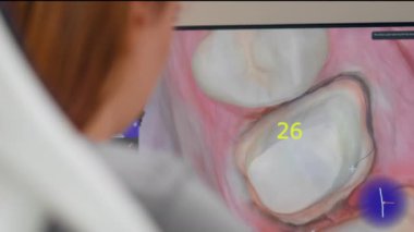 Diş protezleri üretimi için profesyonel laboratuarı kapatın. Üç boyutlu diş kaplamaları. Bir bilgisayar tartışmasında ileri düzeyde çalışma.