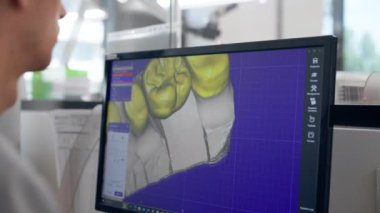 Diş protozoası kaplamaları ve kaplamaları üretmek için profesyonel laboratuarı kapatın. Bir tarama makinesi diş izi oluşturmak için 360 derece döngü profesyonel denetim