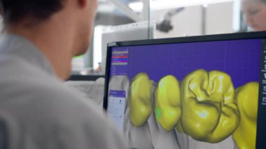 Diş protozoası kaplamaları ve kaplamaları üretmek için profesyonel laboratuarı kapatın. Bir tarama makinesi diş izi oluşturmak için 360 derece döngü profesyonel denetim