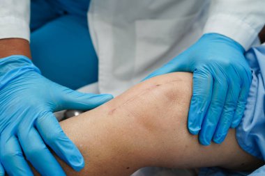 Doktor, hastanede dizinde yara izi olan Asyalı yaşlı kadın hastayı kontrol ediyor..