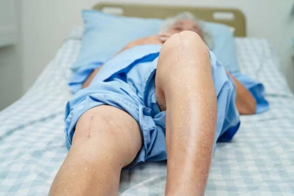 Пациентка Азиатка Шрамом Колене После Операции Больнице — стоковое фото