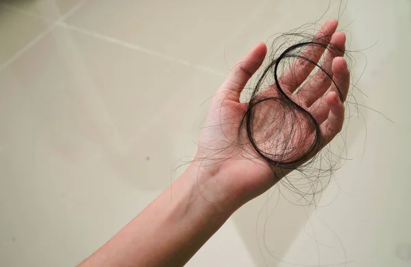 Asian Woman Have Problem Long Hair Loss Attach Her Hand — стоковое фото