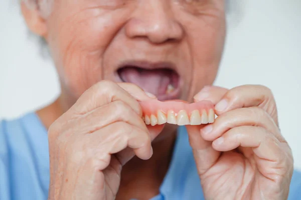 Asiatique Femme Âgée Patient Portant Des Dents Prothèse Dentaire Dans — Photo