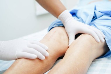 Doktor, hastanede dizinde yara izi olan Asyalı yaşlı kadın hastayı kontrol ediyor..