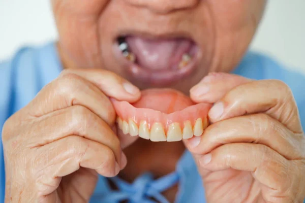 Asiatique Femme Âgée Patient Portant Des Dents Prothèse Dentaire Dans — Photo