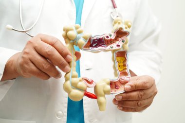 Mide hastalığı, hastanede teşhis ve tedavi için anatomi modeli tutan bir doktor.