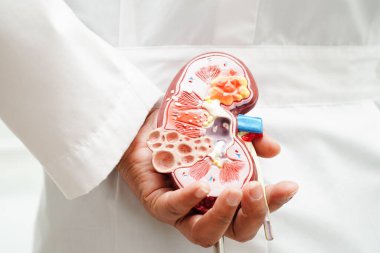 Kronik böbrek hastalığı, doktor idrar sistemi, üroloji, tahmini küresel filtreleme oranı eGFR.