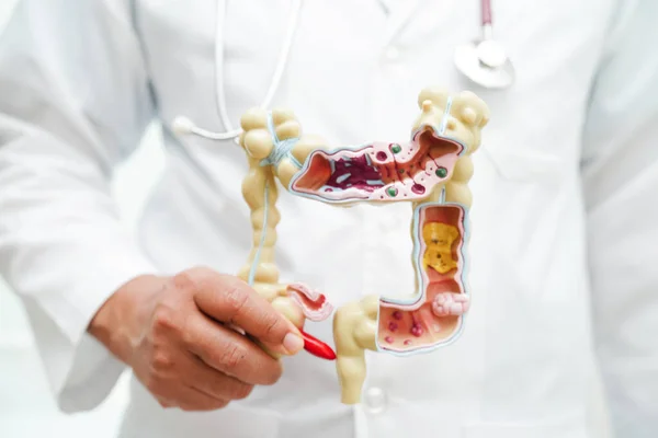 stock image Intestine, doctor holding anatomy model for study diagnosis and treatment in hospital.