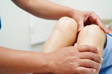 Doktor, hastanede dizinde yara izi olan Asyalı yaşlı kadın hastayı kontrol ediyor..