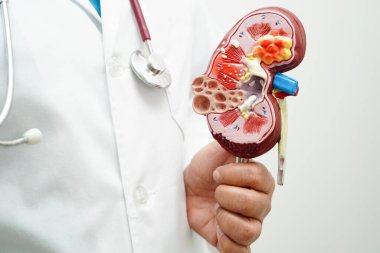 Kronik böbrek hastalığı, doktor idrar sistemi, üroloji, tahmini küresel filtreleme oranı eGFR.