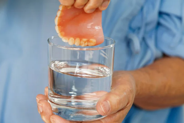 Asiatico Anziana Donna Paziente Denti Puliti Dentiera Bicchiere Con Soluzione — Foto Stock