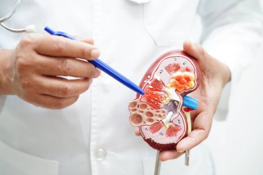 Kronik böbrek hastalığı, doktor idrar sistemi, üroloji, tahmini küresel filtreleme oranı eGFR.