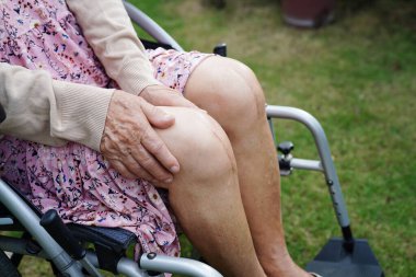 Hastanede dizinde yara izi olan Asyalı yaşlı bir hasta var..