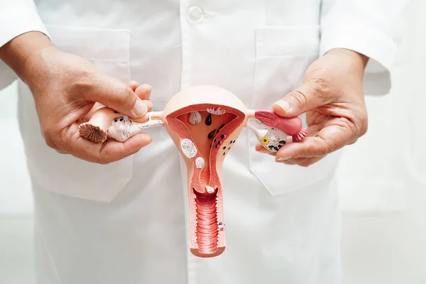 stock image Uterus, doctor holding anatomy model for study diagnosis and treatment in hospital.