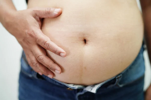 stock image Asian woman show fat belly big size overweight and obesity at office.