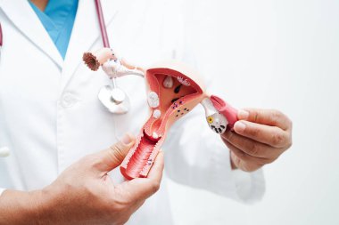 Rahim, hastanede teşhis ve tedavi için anatomi modeli tutan doktor..
