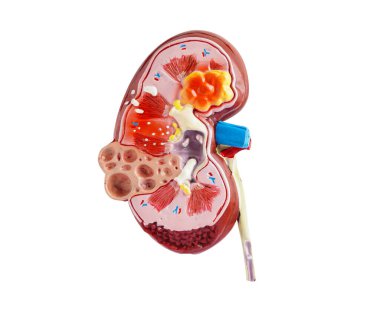 Kidney model isolated on white background with clipping path. Chronic kidney disease, treatment urinary system, urology, Estimated glomerular filtration rate eGFR. clipart