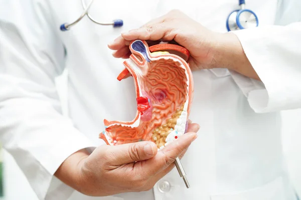 Enfermedad Estomacal Modelo Anatomía Del Médico Posesión Para Diagnóstico Tratamiento —  Fotos de Stock