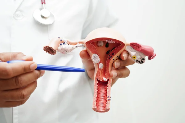 stock image Uterus, doctor holding anatomy model for study diagnosis and treatment in hospital.