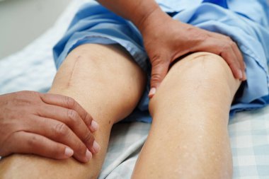Doktor, hastanede dizinde yara izi olan Asyalı yaşlı kadın hastayı kontrol ediyor..