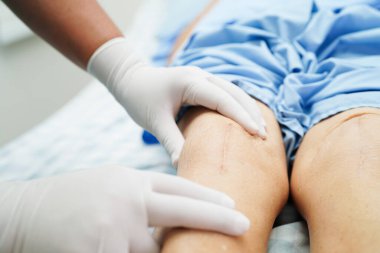 Doktor, hastanede dizinde yara izi olan Asyalı yaşlı kadın hastayı kontrol ediyor..