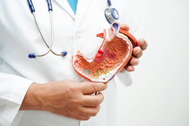 Mide hastalığı, hastanede teşhis ve tedavi için anatomi modeli tutan bir doktor..