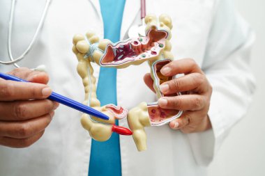 Bağırsak, hastanede teşhis ve tedavi için anatomi modeli tutan doktor..