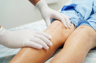 Doktor, hastanede dizinde yara izi olan Asyalı yaşlı kadın hastayı kontrol ediyor..