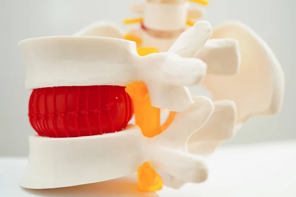 Páteřní Nerv Kost Fragment Lopatkového Obratle Model Pro Léčbu Ortopedickém — Stock fotografie