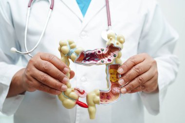 Bağırsak, hastanede teşhis ve tedavi için anatomi modeli tutan doktor..