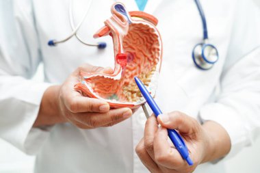 Mide hastalığı, hastanede teşhis ve tedavi için anatomi modeli tutan bir doktor..