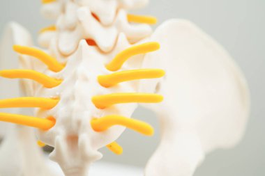 Omurga ve kemik, bel kemiği yerinden oynamış disk parçası, ortopedi bölümünde tedavi için model..