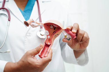 Rahim, hastanede teşhis ve tedavi için anatomi modeli tutan doktor..