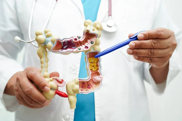 Jelito Grube Lekarz Posiadający Model Anatomii Diagnostyki Leczenia Szpitalu — Zdjęcie stockowe
