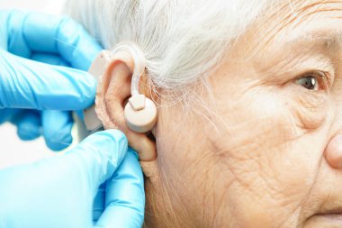 Doktor işitme kaybını azaltmak için yaşlı hasta kulağına işitme cihazı takıyor..