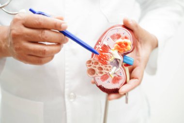 Kronik böbrek hastalığı, doktor idrar sistemi, üroloji, tahmini küresel filtreleme oranı eGFR.