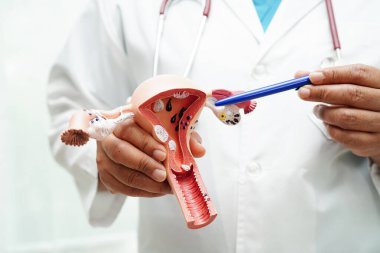 Rahim, hastanede teşhis ve tedavi için anatomi modeli tutan doktor..