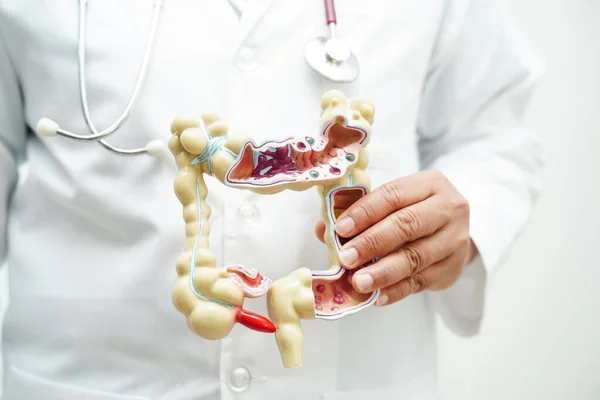 stock image Intestine, doctor holding anatomy model for study diagnosis and treatment in hospital.