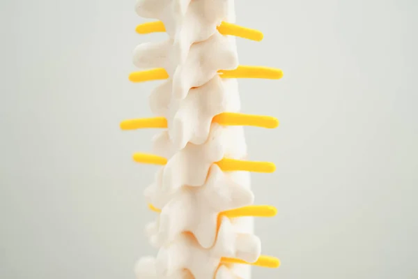 脊髄神経と骨 ラムバルスパインは 整形外科の治療医療のためのヘルニアディスク断片 モデルを変えました ロイヤリティフリーのストック画像