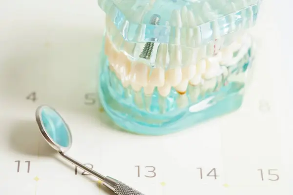 Rappel Rendez Vous Dentaire Dans Calendrier Dents Saines Soins Dentaires — Photo