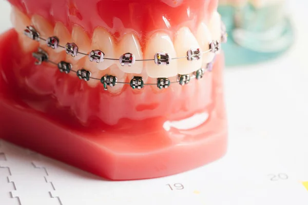 Przypomnienie Wizyty Dentysty Kalendarzu Zdrowe Zęby Opieka Stomatologiczna — Zdjęcie stockowe