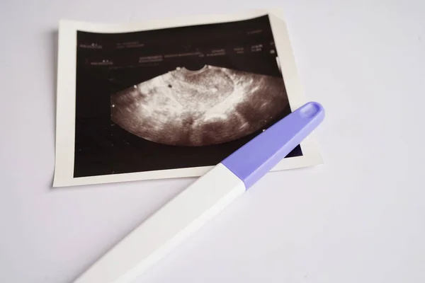 Pregnancy test with ultrasound scan photo of fetus, maternity, childbirth, birth control.