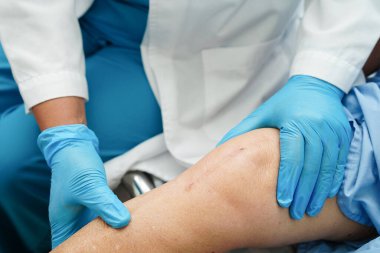 Doktor, hastanede dizinde yara izi olan Asyalı yaşlı kadın hastayı kontrol ediyor..