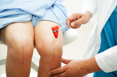 Asyalı doktor, hastanedeki yaşlı hastayı muayene etmek için diz refleksi sinirine vurdu..