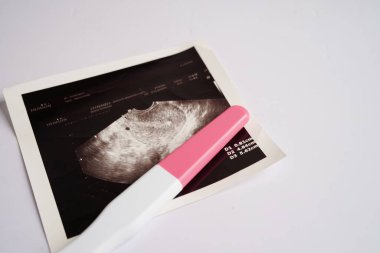 Hamilelik testi ultrason taraması ile fetüsün, hamileliğin, doğumun, doğum kontrolünün fotoğrafı..