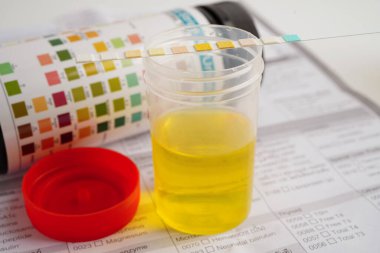 İdrar tahlili, reaksiyonlu idrar kabı. PH kağıt testi ve karşılaştırma tablosu laboratuvarda..