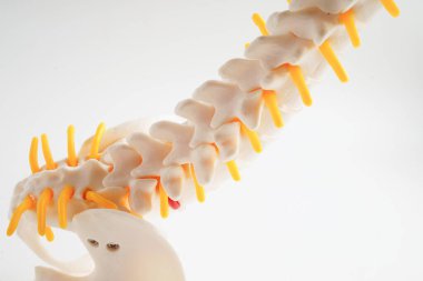 Omurga ve kemik, bel kemiği yerinden oynamış disk parçası, ortopedi bölümünde tedavi için model..