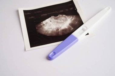 Hamilelik testi ultrason taraması ile fetüsün, hamileliğin, doğumun, doğum kontrolünün fotoğrafı..
